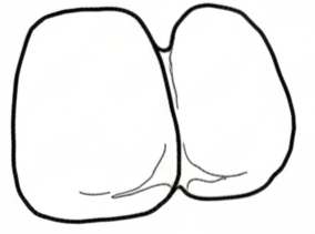 Close Contact