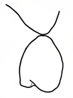 Partial Ridge Lap